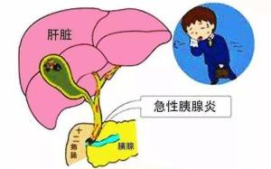 急性胰腺炎不能小视